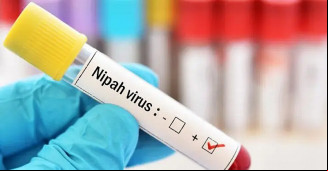 Nipah: vírus tem taxa de mortalidade de 40% a 75%