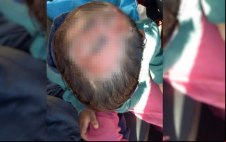 Investigações apontaram que ele não foi queimado pelo pai, como indicava apuração inicial, em Formosa. Garoto voltou à família, seguindo decisão do Juizado da Infância e Juventude.